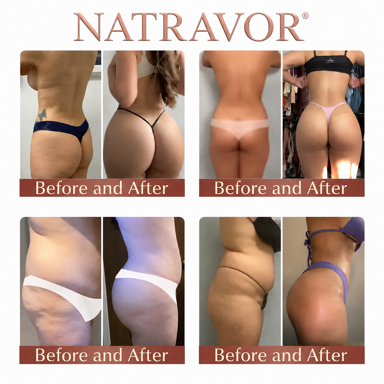 NATRAVOR® CurveSculpt Micro-Patch ✦ Sculpt • Firm • Smooth Lower Body Curves ✦ Micro-Needle Infusion System