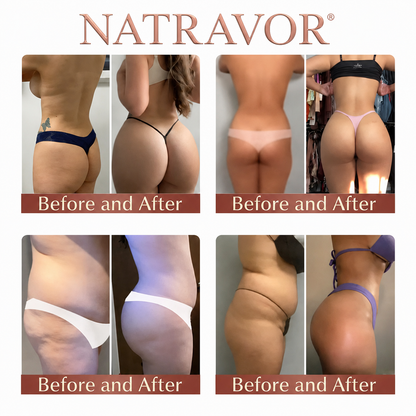 NATRAVOR® CurveSculpt Micro-Patch ✦ Sculpt • Firm • Smooth Lower Body Curves ✦ Micro-Needle Infusion System