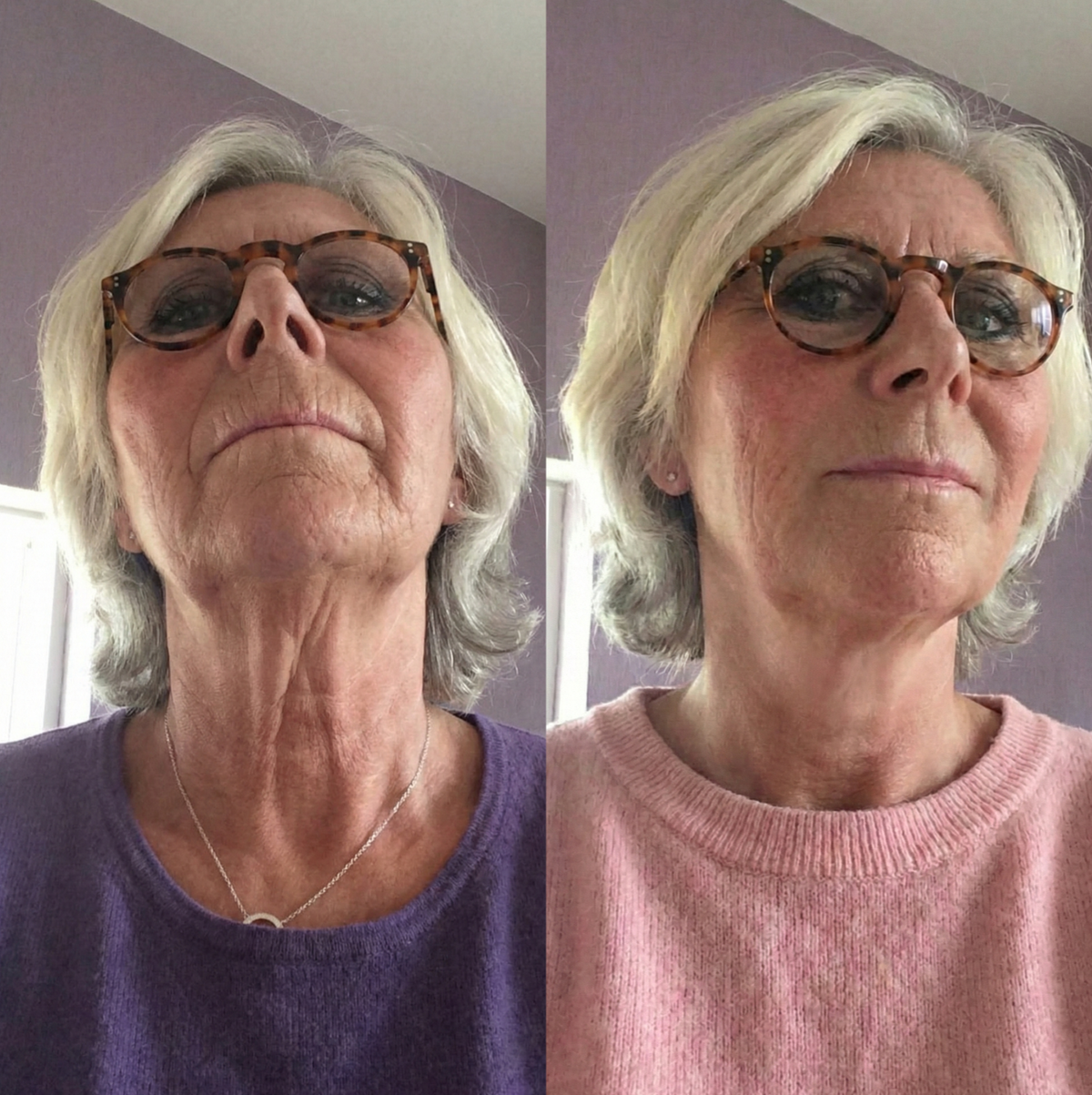 𝐍𝐚𝐭𝐫𝐚𝐯𝐨𝐫® PDRN Soin Anti-Rides – Crème Liftante et Raffermissante