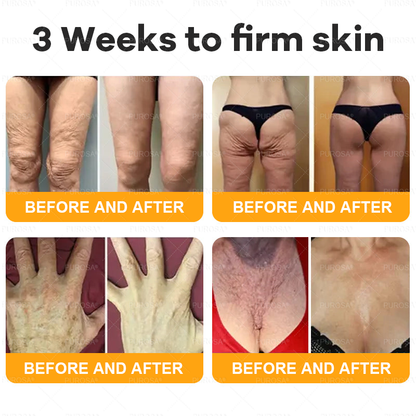 NATRAVOR® 𝘽𝙀𝙀 𝙑𝙀𝙉𝙊𝙈 𝙎𝙠𝙞𝙣 𝙍𝙚𝙨𝙩𝙤𝙧𝙖𝙩𝙞𝙤𝙣 𝘾𝙧𝙚𝙖𝙢 –🌸 Anti-aging,Hydrating, Skin Repair, Even Tone, Acne and Dark Spot Treatment, Wart and Mole Removal, Psoriasis Relief