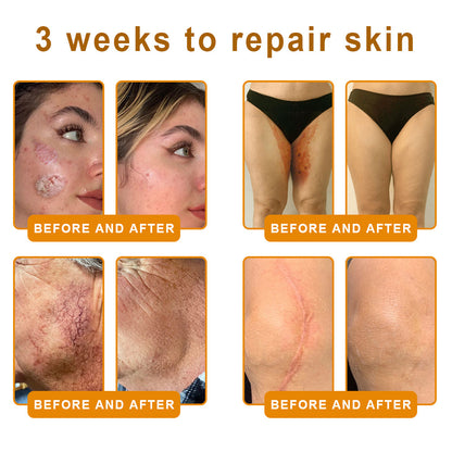 NATRAVOR® 𝘽𝙀𝙀 𝙑𝙀𝙉𝙊𝙈 𝙎𝙠𝙞𝙣 𝙍𝙚𝙨𝙩𝙤𝙧𝙖𝙩𝙞𝙤𝙣 𝘾𝙧𝙚𝙖𝙢 –🌸 Anti-aging,Hydrating, Skin Repair, Even Tone, Acne and Dark Spot Treatment, Wart and Mole Removal, Psoriasis Relief