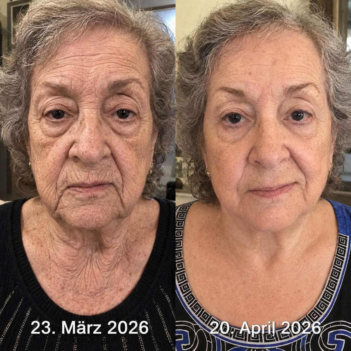 𝐍𝐚𝐭𝐫𝐚𝐯𝐨𝐫® PDRN Soin Anti-Rides – Crème Liftante et Raffermissante