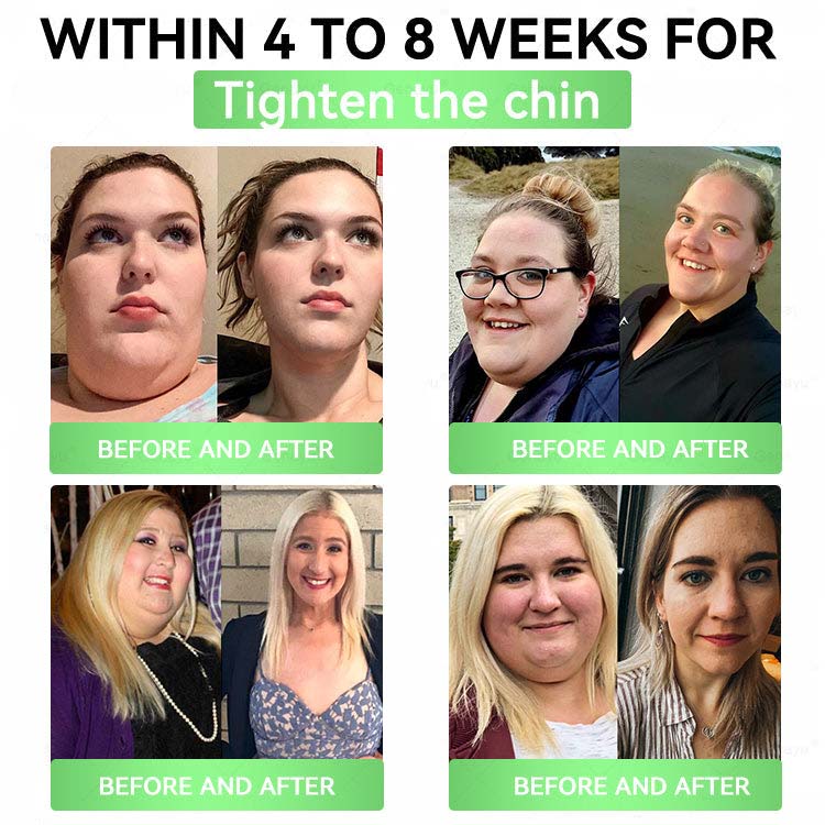 Vilnexa™ 8-in-1 AMPK Metabolic Slimming Patch 🇺🇸 Moringa × Berberine Formula · Supports Weight Management, Metabolic Balance & Daily Comfort