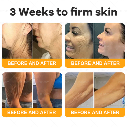 NATRAVOR® 𝘽𝙀𝙀 𝙑𝙀𝙉𝙊𝙈 𝙎𝙠𝙞𝙣 𝙍𝙚𝙨𝙩𝙤𝙧𝙖𝙩𝙞𝙤𝙣 𝘾𝙧𝙚𝙖𝙢 –🌸 Anti-aging,Hydrating, Skin Repair, Even Tone, Acne and Dark Spot Treatment, Wart and Mole Removal, Psoriasis Relief