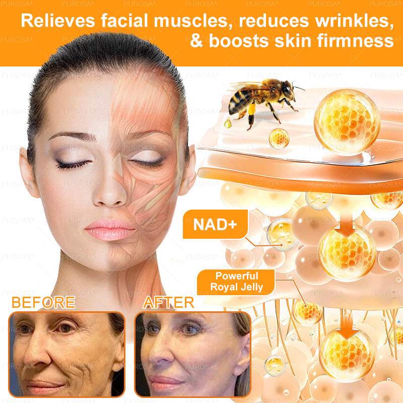 NATRAVOR® 𝘽𝙀𝙀 𝙑𝙀𝙉𝙊𝙈 𝙎𝙠𝙞𝙣 𝙍𝙚𝙨𝙩𝙤𝙧𝙖𝙩𝙞𝙤𝙣 𝘾𝙧𝙚𝙖𝙢 –🌸 Anti-aging,Hydrating, Skin Repair, Even Tone, Acne and Dark Spot Treatment, Wart and Mole Removal, Psoriasis Relief