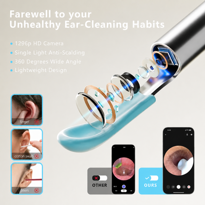 1080P Visual Ear Wax Removal Kit with Camera & App – Rechargeable Ear Cleaner with 8 Soft Silicone Tips